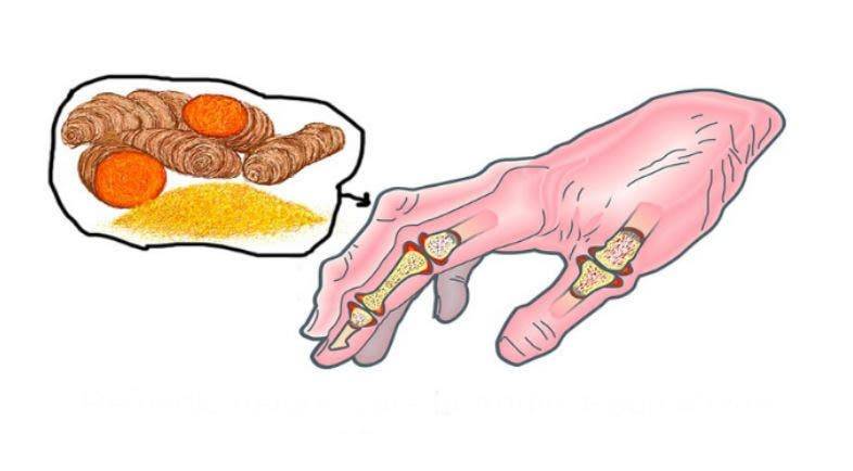 L’ allergie et l’arthrite peuvent également causer de la douleur dans la dent !